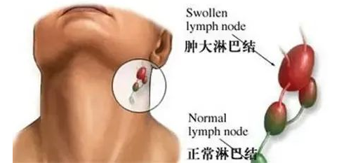 What is lymph?
