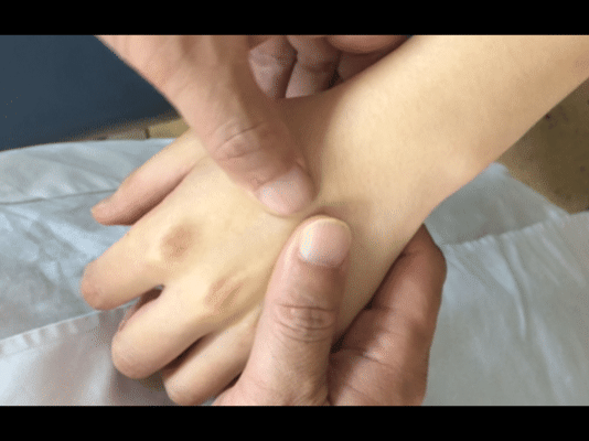 Lymphatic drainage technique 5: round the thumb